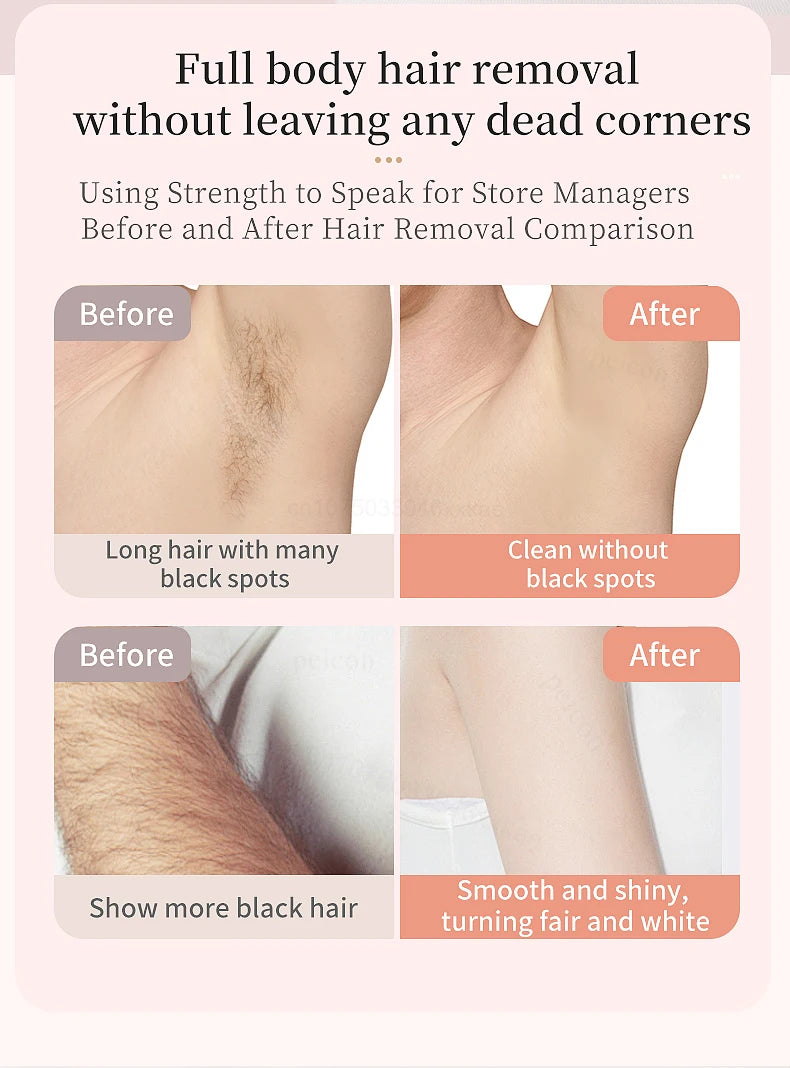 Épilateur pour le visage et la moustache مزيل شعر الوجه والشاربz